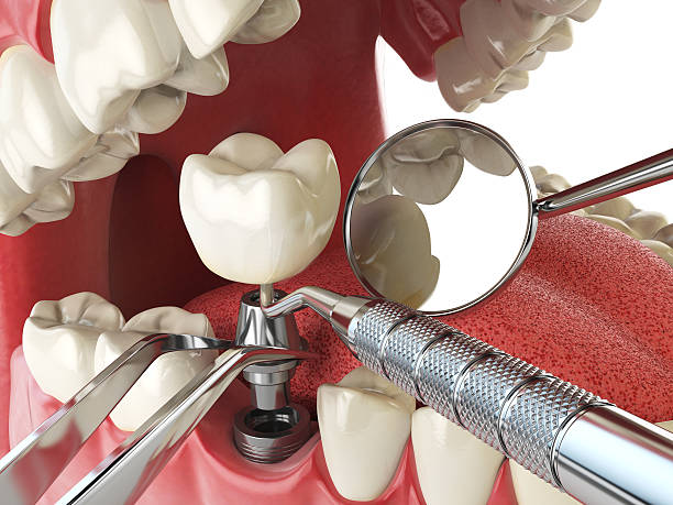 Best Emergency Orthodontic Repairs in Staic, CA